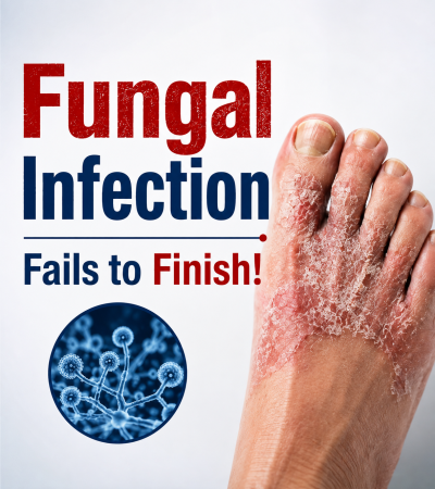 fungal